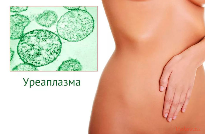 Как лечить уреаплазму у женщин