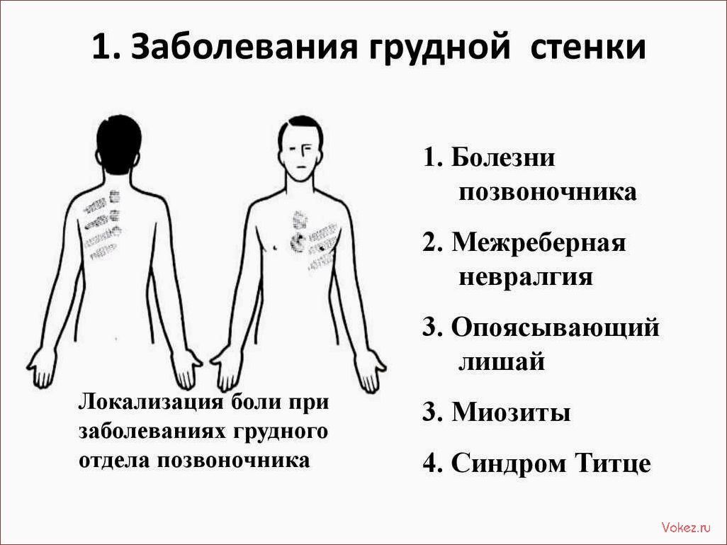 (боли, сердце, невралгия, отличить, рассказывает) Боли в сердце или невралгия — как отличить? Рассказывает кардиолог