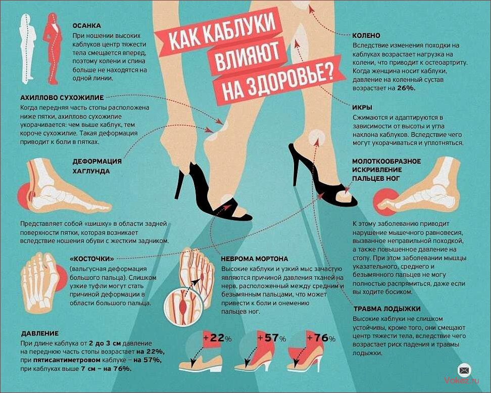Высокое напряжение — почему каблуки негативно влияют на женское здоровье