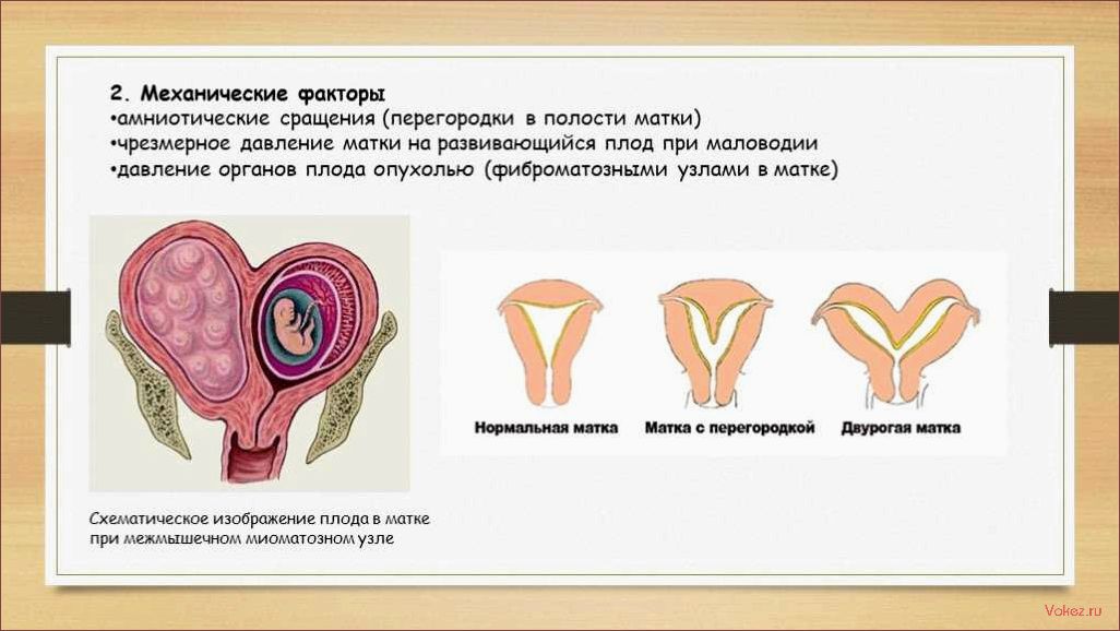 (жизнь, женщины, двумя, матками, выносила) Жизнь женщины с двумя матками — она выносила по ребенку в левой и в правой