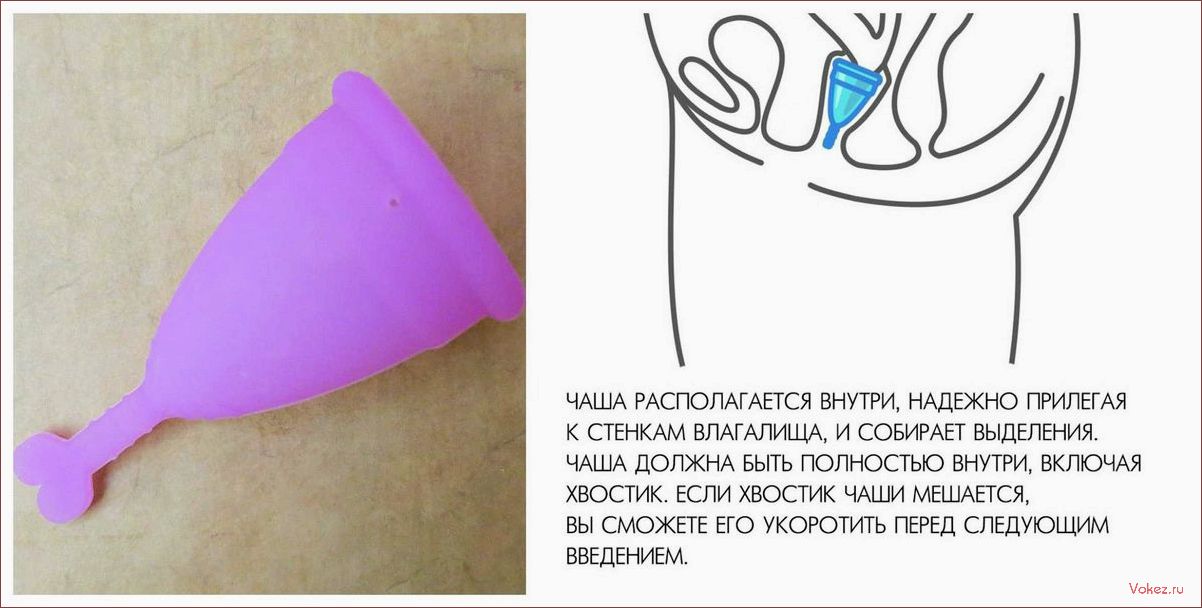 (менструальные, чаши, стать, полноценной) Могут ли менструальные чаши стать полноценной альтернативой прокладкам и тампонам? Советы гинеколога