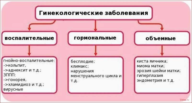 (неочевидные, признаки, свидетельствовать) Неочевидные признаки, которые могут свидетельствовать о гинекологических заболеваниях