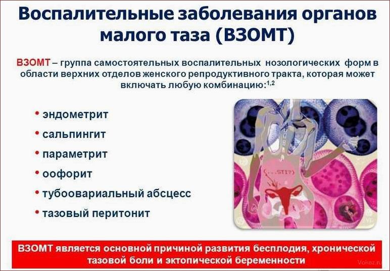 (неочевидные, признаки, свидетельствовать) Неочевидные признаки, которые могут свидетельствовать о гинекологических заболеваниях