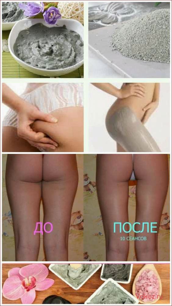 (эффективные, обертывания, целлюлита, похудения, домашних) Эффективные обертывания от целлюлита для похудения в домашних условиях — проверенные способы избавления от
