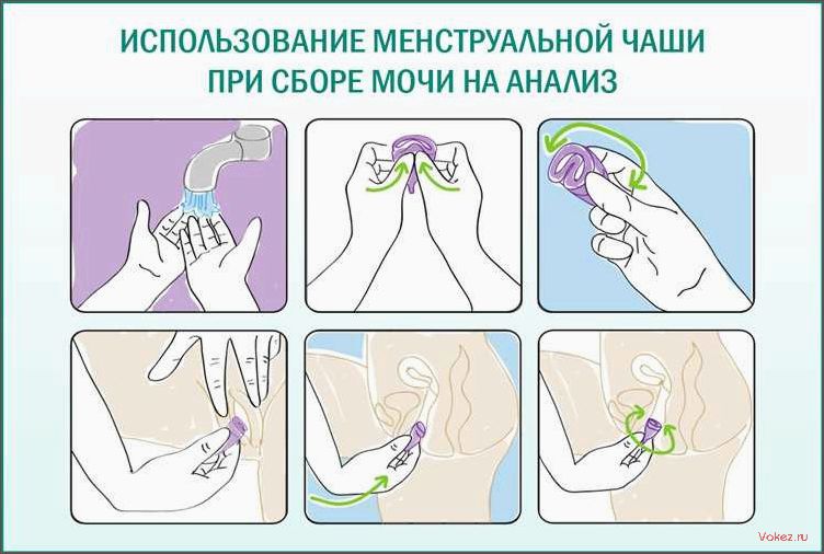 (использование, менструального, белья) Почему использование менструального белья является более выгодным и безопасным решением, чем использование тампонов и прокладок — разъяснение гинеколога
